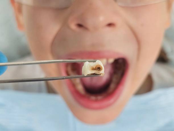 Best Walk-In Emergency Dentist in Ossun, LA